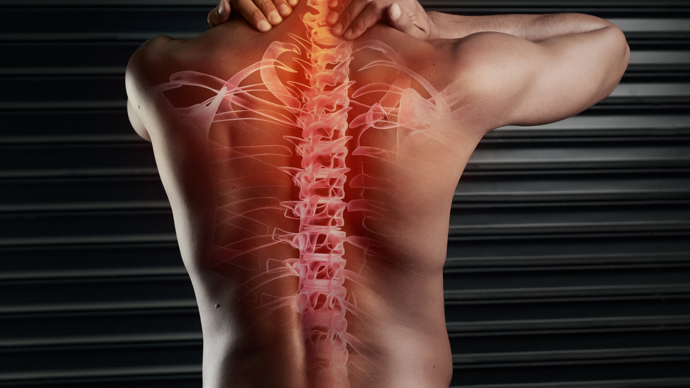 spinal cord stimulation